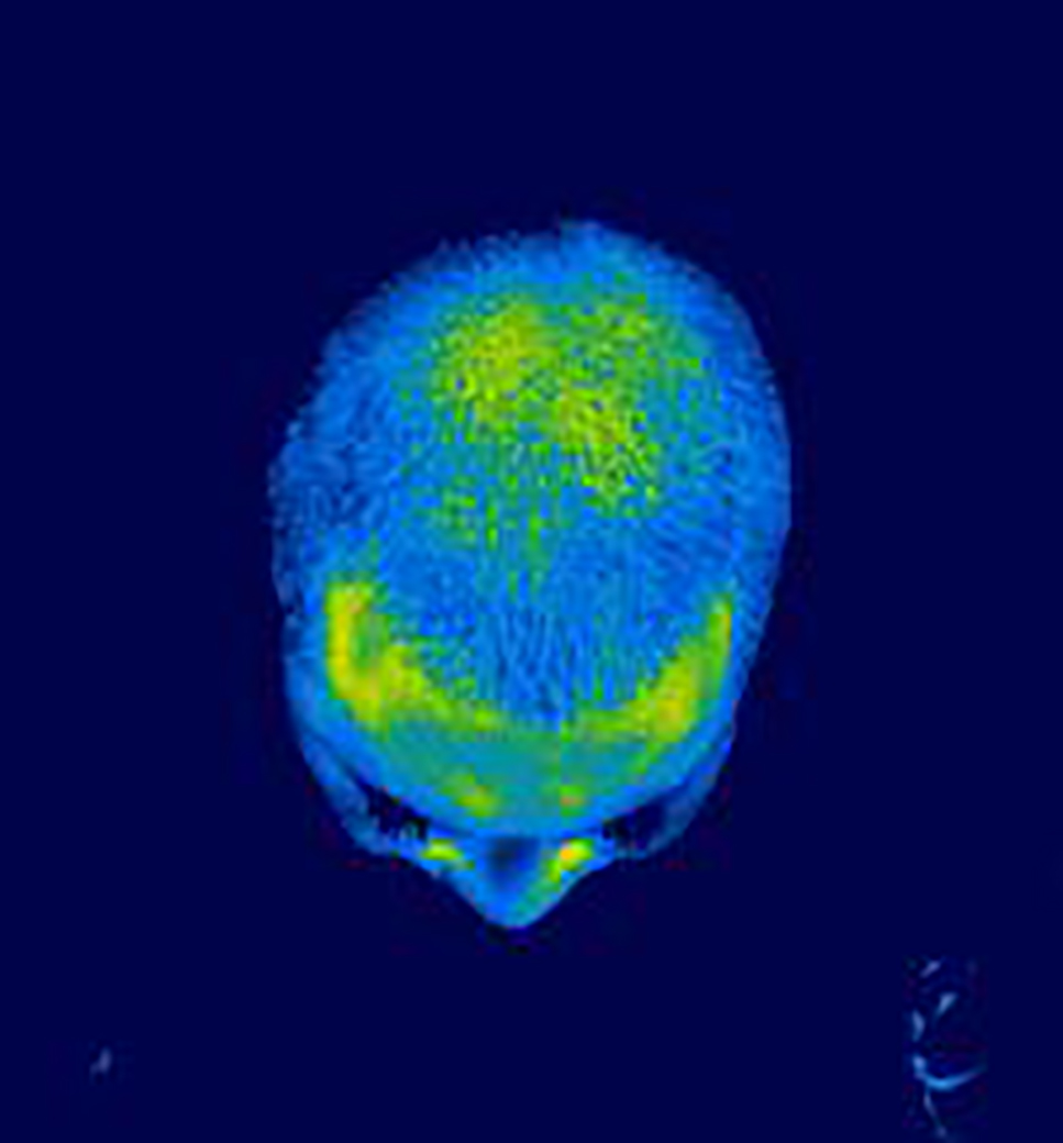 %e3%82%b5%e3%83%bc%e3%83%a2%e4%bd%bf%e7%94%a8%e5%89%8d