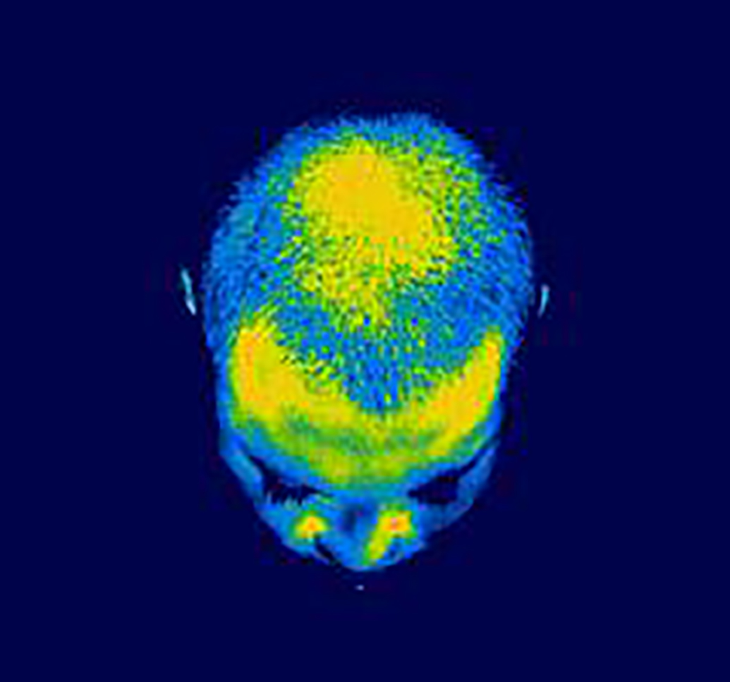 %e3%82%b5%e3%83%bc%e3%83%a2%e4%bd%bf%e7%94%a8%e5%be%8c